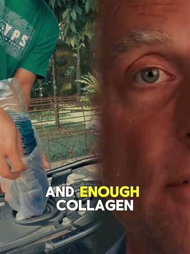 ⚠️ The MOST Dangerous Sign of Collagen Deficiency (Don’t Ignore This!) #collagen