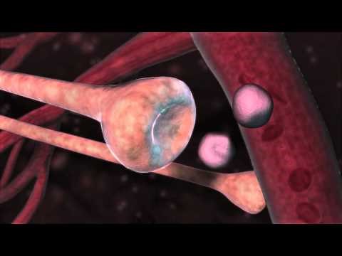 Peripheral Sensitization