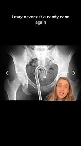 56K views · 2.4K reactions | Hilariously Embarrassing X-Rays 領 | onlyjayus | Facebook
