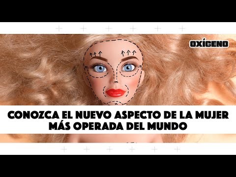 Mujer más operada del mundo: conozca su nuevo aspecto