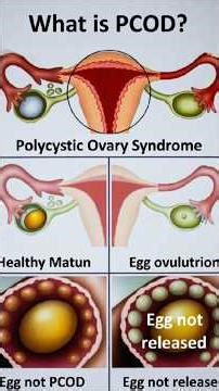 “PCOD Explained in 1 minute | Symptoms, Causes & Real Solution”