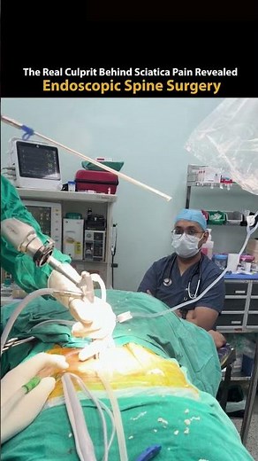 The Real Culprit Behind Sciatica Pain Revealed! | Endoscopic Spine Surgery