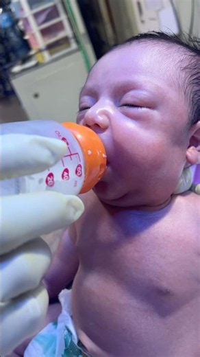 Cute Infant of Diabetic Mother Baby 👶💙 | NICU Feeding Moment #cutebaby #neonatologist
