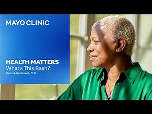 Dermatitis Explained: Eczema, Dandruff and Rashes | Mayo Clinic Health Matters Podcast