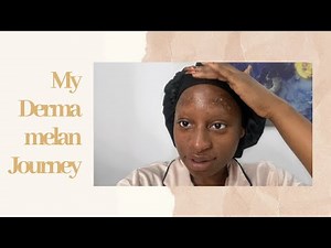 My Dermamelan Journey USING MESOESTETIC DERMAMELAN ON DARK SKIN | chemical peel