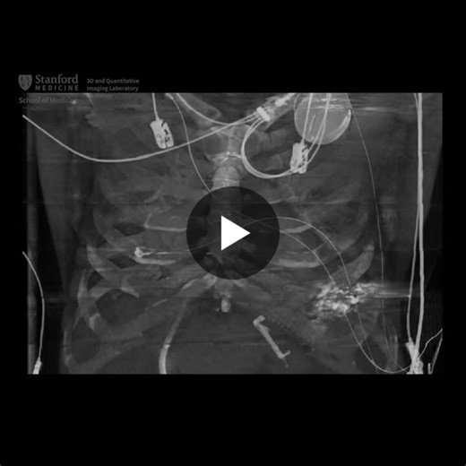 #3dimaging #4dimaging #heart | Stanford 3D Quantitative Imaging Laboratory