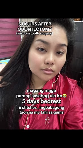 Understanding Odontectomy: Wisdom Tooth Surgery Explained