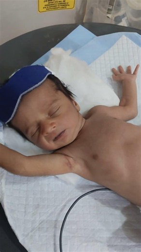 A lettle baby so cute🥰🥰👍👍 #hospitalwork #youtubeshort #viralshort #cutebaby #nicuwork