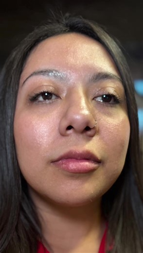 💋 Beautiful, Balanced Lips with Versa 💋 This gorgeous transformation was created with 0.6 mL of Versa Lip Filler — the perfect amount for adding soft volume, definition, and hydration while still keeping the lips natural and elegant. At Oasis Beauty Lounge, every lip treatment is carefully customized to enhance your natural lip shape and facial harmony. My goal is always balanced, luxurious, natural-looking results. ✨ Treatment: Versa Lip Filler ✨ Amount: 0.6 mL ✨ Result: Fuller, defined, and 