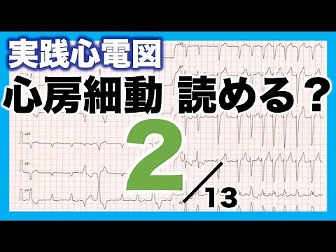 [How to read an electrocardiogram ②] Atrial fibrillation
