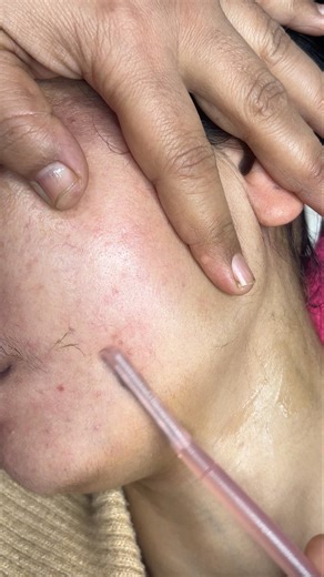 Face shaving by carmesi razor/ Facial hair removal tutorial/ #Faceshaving #skincare #beauty #shave