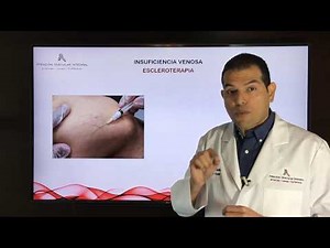7 Insuficiencia Venosa Escleroterapia