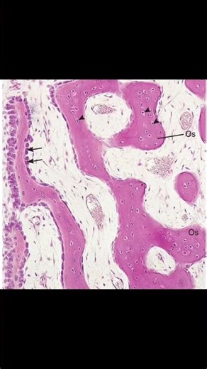 Light micrograph of intramembranous ossification (×132).