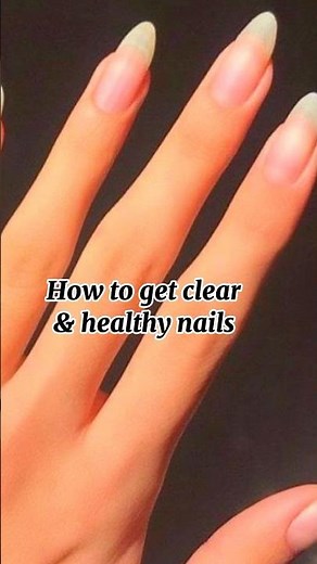 How to get clear & healthy nails 💅#nailscare #subscribe