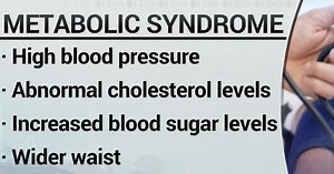 Research shows that more than one-third of adults have metabolic syndrome