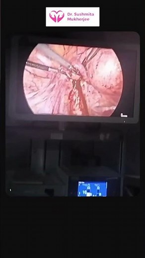 Laparoscopic Treatment of Pelvic Endometriosis with Adhesiolysis – Dr Sushmita Mukherjee
