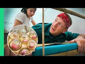 FIRE CUPPING and SEAHORSE TEA in China! Welcome to Traditional Chinese Medicine!