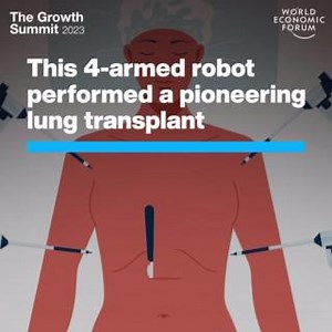 13K views · 336 reactions | The pioneering procedure ensures patients...