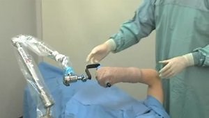 SPIDER2 Limb Positioner Technique Demonstration