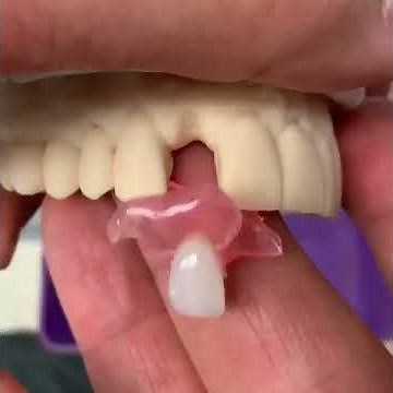 3D printed Mini Dentures