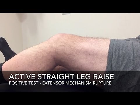 Extensor Mechanism - Active SLR Test