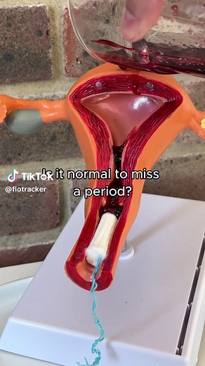 Missed Period Insights: What’s Normal and When to Seek Help