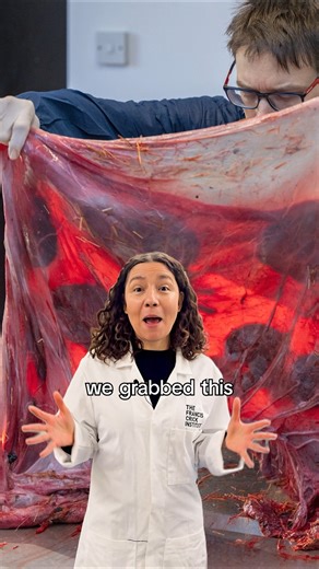 Why does she have giraffe placenta in her freezer?