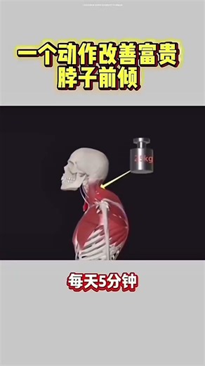 Exercise for removing back pain and straightening the shoulders #backpain #lowbackpain #fitness