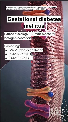 Gestational diabetes mellitus