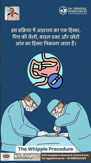 Whipple surgery is a complex procedure to treat pancreatic, bile duct, or duodenal cancers.