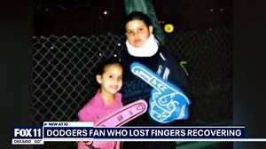Dodgers Fan Loses Two Fingers Due To World Series Firework Mishap