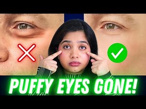 👀 How to Get Rid of Eye Puffiness and Under Eye Bags?