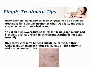 Pimple Treatment Tips For Your Skin