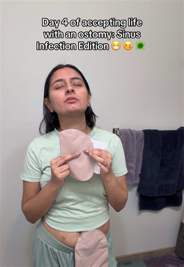Changing your ostomy wafer while sick is not for the faint of heart!! Ostomy life always knows how to keep it exciting 😅 #ostomy #ostomate #colostomy #ileostomy #stoma