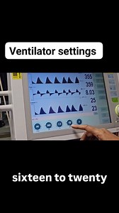 Life-in-icu 👈 follow for more clinical tips on ✨️🩺🏥#lifeinicu #drarchanasinha #criticalcare #ICULearning #icudoctor #icunurse #medicalstudents #respiratorytherapist #savealife #stayhealthy ✨️🩺🏥*Basic Ventilator Settings:* - *Tidal Volume (Vt):* 6-8 mL/kg (ideal body weight) - *Respiratory Rate (RR):* 12-20 breaths/min - *FiO2:* 40-100% (titrate to SpO2 >92%) - *PEEP:* 5-8 cmH2O - *Inspiratory Pressure:* 10-20 cmH2O (pressure-controlled modes) - *Modes:* - *CMV (Controlled Mandatory Ventilat