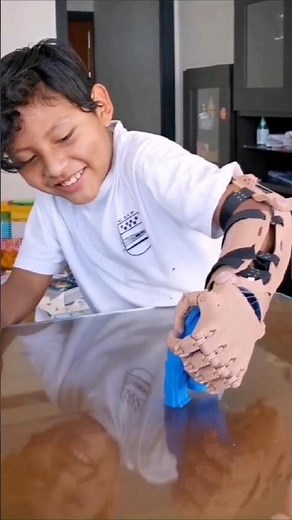 To drive, to drum, to live again - with 3D printed prosthetics #3dprinting #creality #prosthetics