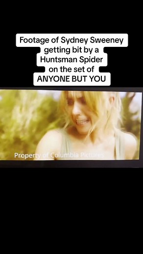 Sydney Sweeney Huntsman Spider Bite Scene | Anyone But You
