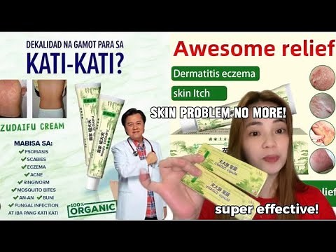 Gamot sa mga kati-kati sa balat | ZUDAIFU REVIEW