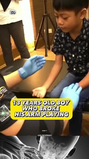 13 years old boy who broke his arm playing #chiropractic #chiropractor #quiropraxia #asmr
