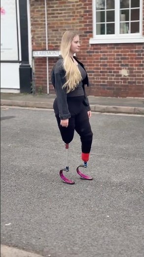 Flawless! Double Amputee Daisy-May Showcases Her Powerful Stride 👑✨ #DoubleAmputee #AmputeeLife