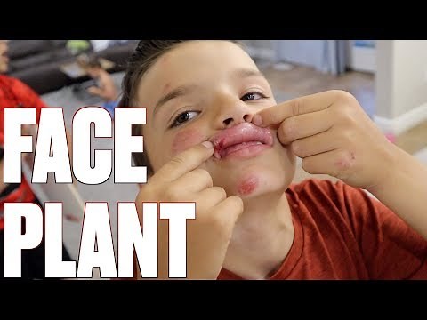 FACE PLANT ON BMX BIKE | FALLING FACE FIRST ONTO THE PAVEMENT | COULD HAVE BEEN WORSE!