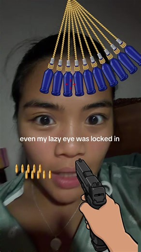 Understanding Lazy Eye: Causes and Trends
