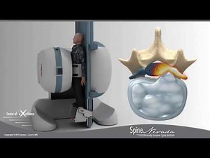 Video demonstrating Open and Weight Bearing MRI diagnosing Lumbar Disc Herniation