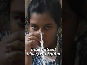 Brock String Exercise in Convergence Insufficiency || Vision Therapy Series