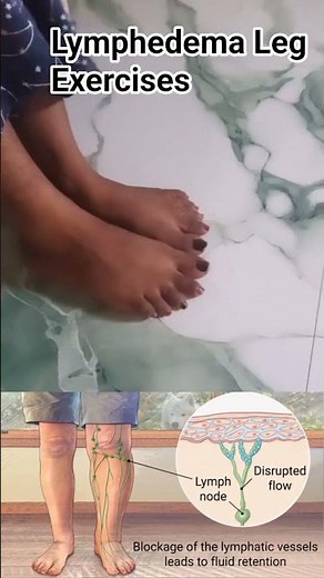 Lymphedema Leg Exercises easy and effective exercise try daily 20reps