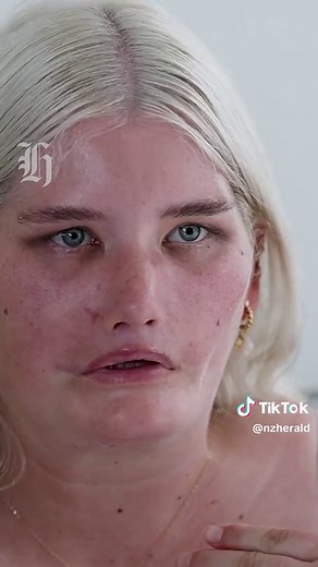 Tayla Clement's Journey with Moebius Syndrome