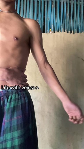 Understanding Veins and Their Role in the Body