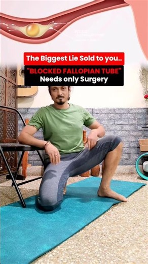 3 Exercises for Blocked Fallopian tubes