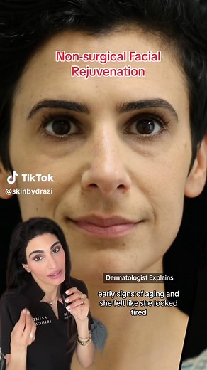 Facial Aging & Rejuvenation explained by a #Dermatologist #over30tiktok #antiaging #transformation #learnontiktok