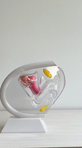 4.2K views · 16 reactions | "How to insert and remove a period disc"...